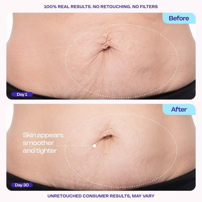 🌸 New! AQA® Tighten & Smooth Belly Firming Cream💖