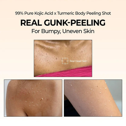 Exfoliating Kojic Acid Turmeric Spray - Skin Care, Whitening, Moisturizing, Suitable for the Whole Body