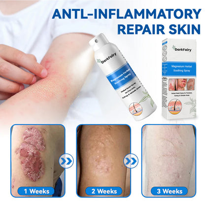 ✅ Official Store: QIAWI Magnesium Herbal Psoriasis Spray 👨‍⚕️MHRA Approved | Relieves psoriasis & eczema, improves genital bacterial infections, treats acne & warts