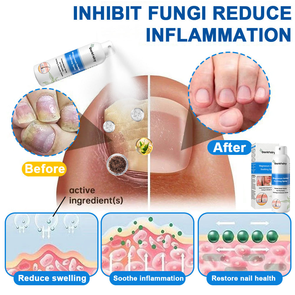 ✅ Official Store: QIAWI Magnesium Herbal Psoriasis Spray 👨‍⚕️MHRA Approved | Relieves psoriasis & eczema, improves genital bacterial infections, treats acne & warts