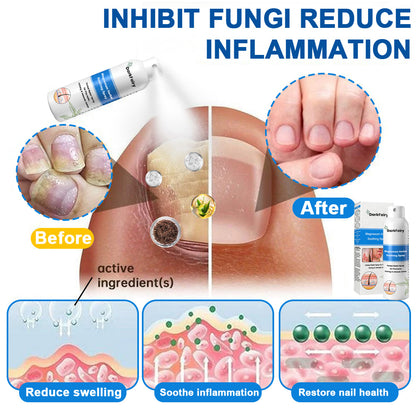 ✅ Official Store: QIAWI Magnesium Herbal Psoriasis Spray 👨‍⚕️MHRA Approved | Relieves psoriasis & eczema, improves genital bacterial infections, treats acne & warts