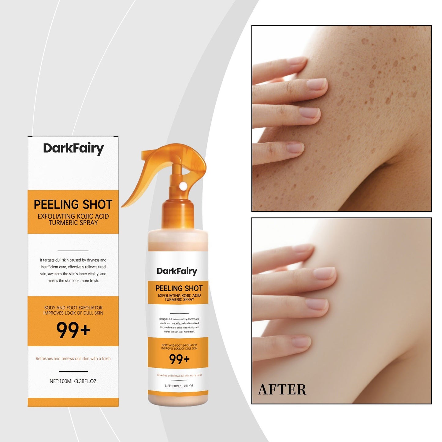 Exfoliating Kojic Acid Turmeric Spray - Skin Care, Whitening, Moisturizing, Suitable for the Whole Body